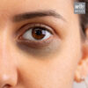 Eye Care | Dark Circles