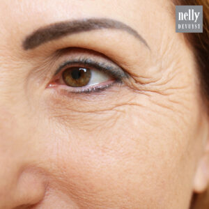 Eye Care | Pronounced Wrinkles